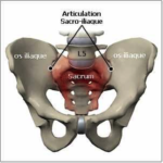 shema-articulation-douloureuse